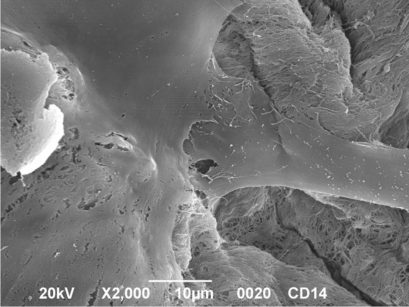 Immagine al microscopio elettronico di cellule staminali seminate su supporti a base di idrossiapatite. Le cellule staminali hanno acquisito un fenotipo osteoblastico