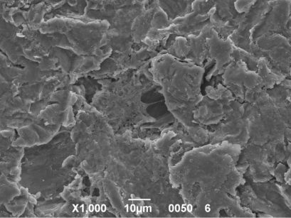 Immagine al microscopio elettronico di cellule staminali seminate su supporti a base di idrossiapatite. Le cellule staminali hanno acquisito un fenotipo osteoblastico