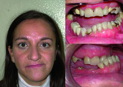5. Quadro odontostomatologico della paziente C.M.                                  