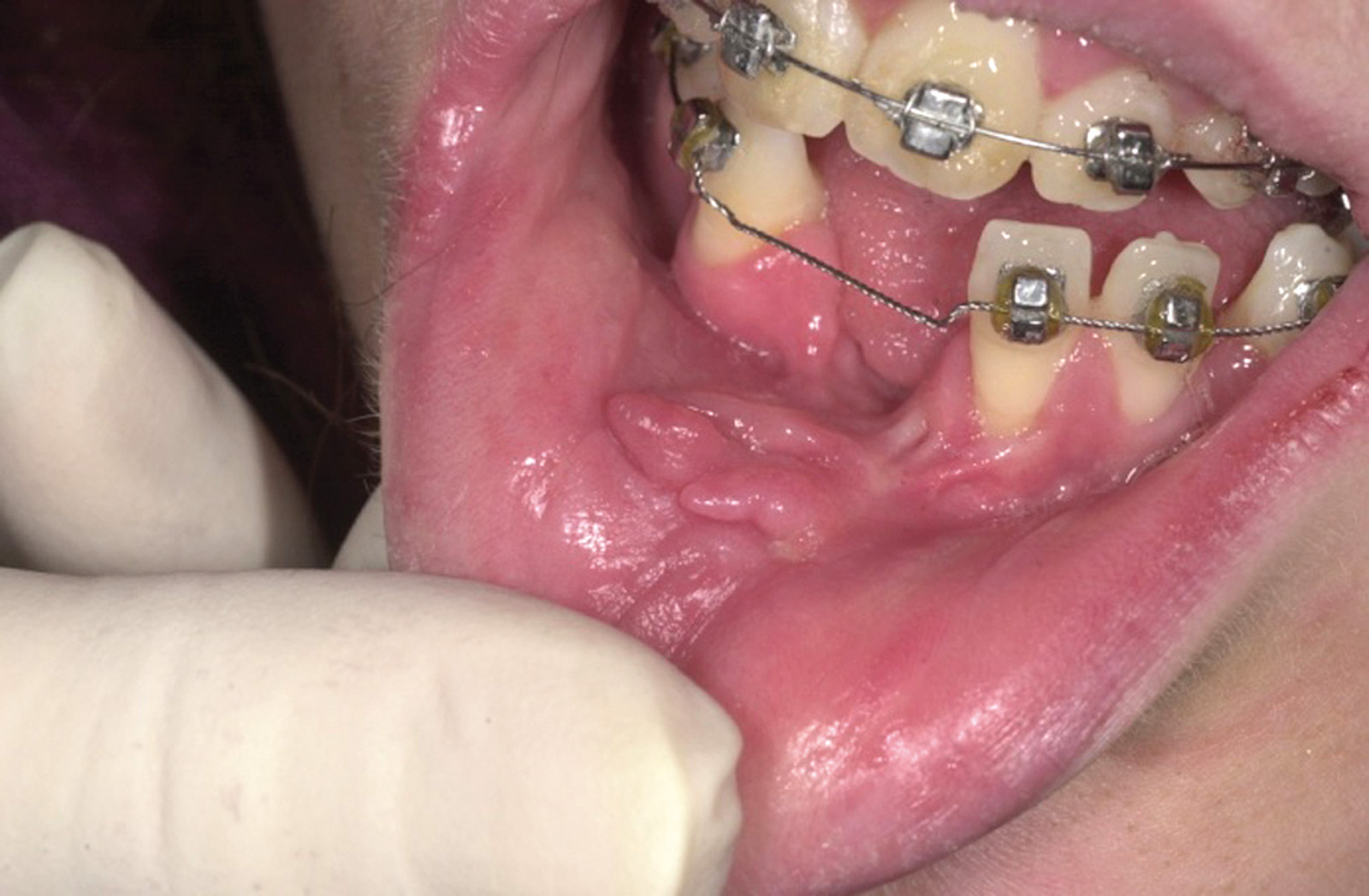 Profili di responsabilità professionale in ortodonzia: errori e complicanze