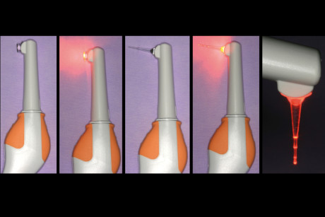 2. Lampada LED di ultima generazione per utilizzo fotodinamico. Si notano i diversi puntali per applicazione parodontale sopra-gengivale e sotto-gengivale. Si vede anche la diffusione della luce nello spazio circostante.