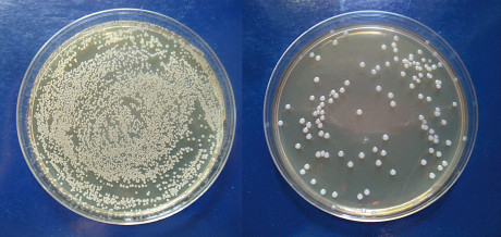 3. Esempi di crescita di colonie di microrganismi su terreno BHI.