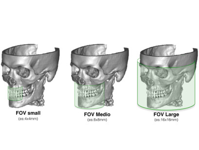 1. Rappresentazione grafica dell’area del cranio coperta dai FOV che sono più comunemente richiesti.