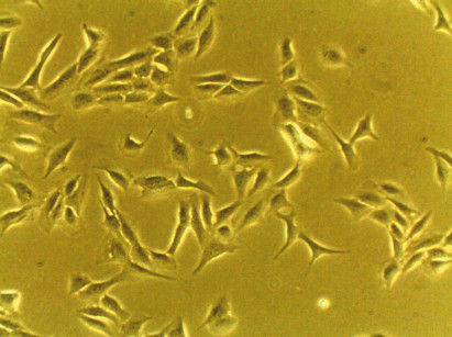 1. Cellule osteoblastiche U2OS (100x).