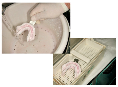 3. Il lavaggio e la disinfezione delle impronte devono essere eseguiti prima dell’invio e al rientro dai laboratori odontotecnici. La procedura deve essere applicata anche ai dispositivi protesici e ortodontici in tutte le fasi di lavorazione, fino alla consegna.