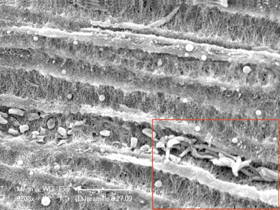 8. Immagine al SEM di dentina radicolare ricoperta di biofilm batterico di E. faecalis prima dell’irradiazione laser.