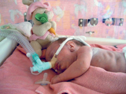7a-7b. Università di Debrecen: unità di terapia intensiva neonatale e un piccolo paziente.