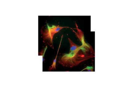Cellule staminali differenziate in laboratorio in cellule neuronali e gliali