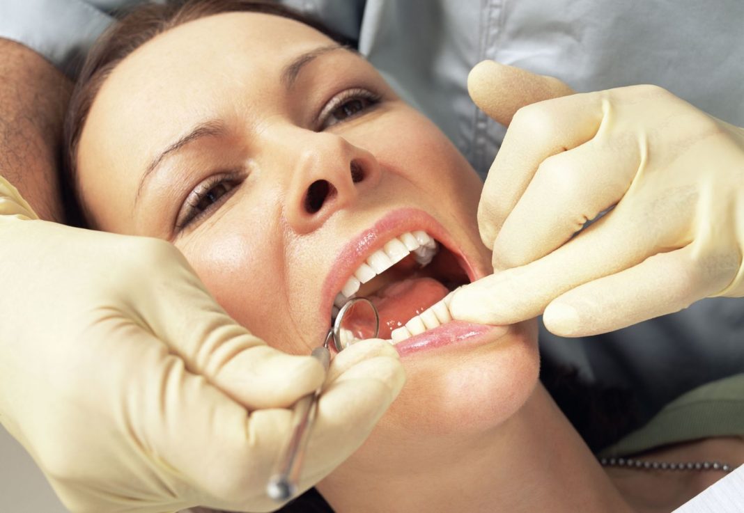 Kinesiografia disodontiasi terzi molari