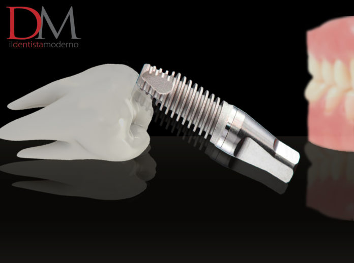 estrusione ortodontica preimplantare lesioni periapicali, impianti dentali, gestione dei tessuti molli perimplantari impianto dentale e dente, perimplantite