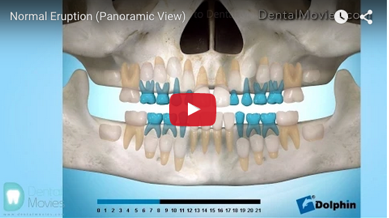 eruzione dentale disodontiasi
