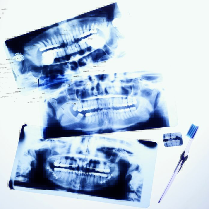 Dentista-moderno-radiologia-odontoiatri-radiologico-radioprotezione