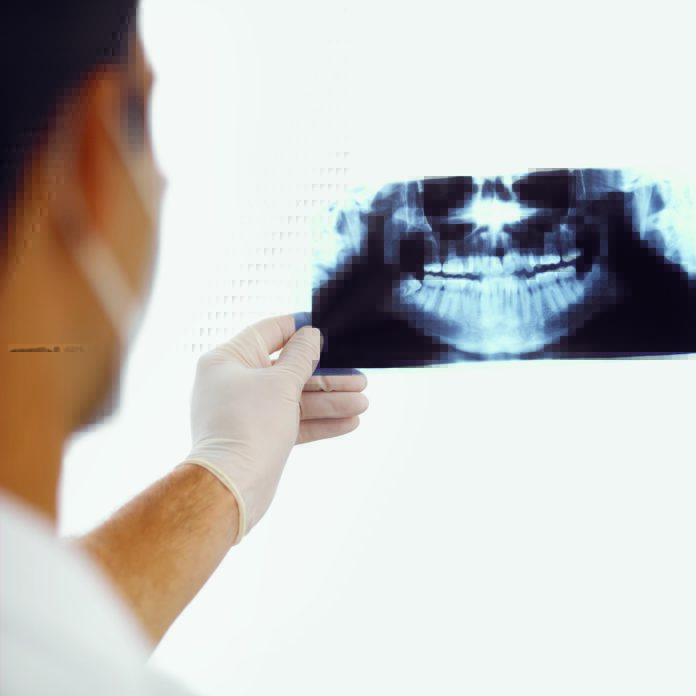 DM_il-dentista-moderno_anatomia-del-parodonto_panoramica_dentista-Composizione dei tessuti parodontali: gengiva e legamento parodontale
