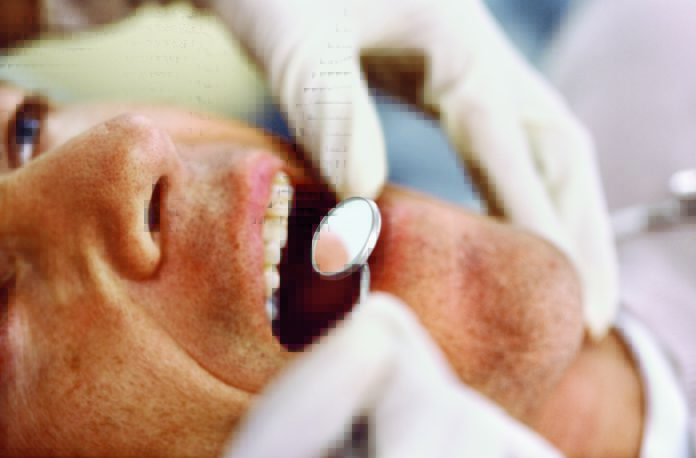 infiammazione parodontale diabete e parodontite Sondaggio parodontale: lo strumento fondamentale per la diagnosi in parodontologia