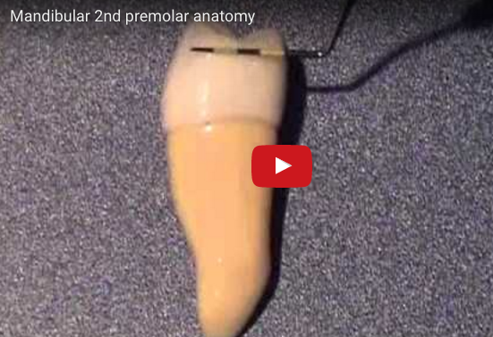 dm_il-dentista-moderno_anatomia-premolari-mascellari-e-mandibolari