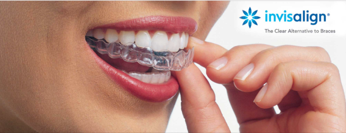 dm_il-dentista-moderno_invisalign_sorriso_allign-technology