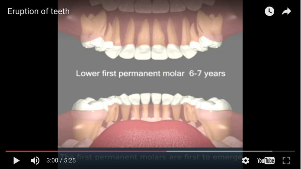 DM_il dentista moderno_agenesie dentarie_schema di eruzione_eruzione denti permanenti eruzione denti decidui
