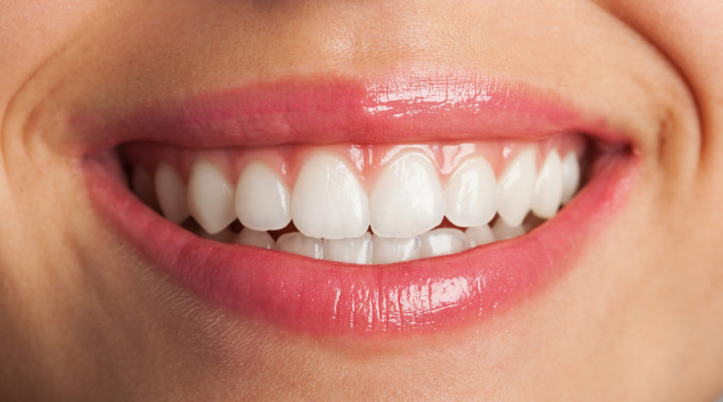 DM_il dentista moderno_ortodonzia_apparecchio_sorriso perfetto_placca di Hawley_incisivi centrali_torque