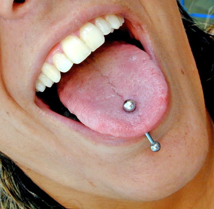 Il piercing alla lingua può causare parodontite e problemi orali 2