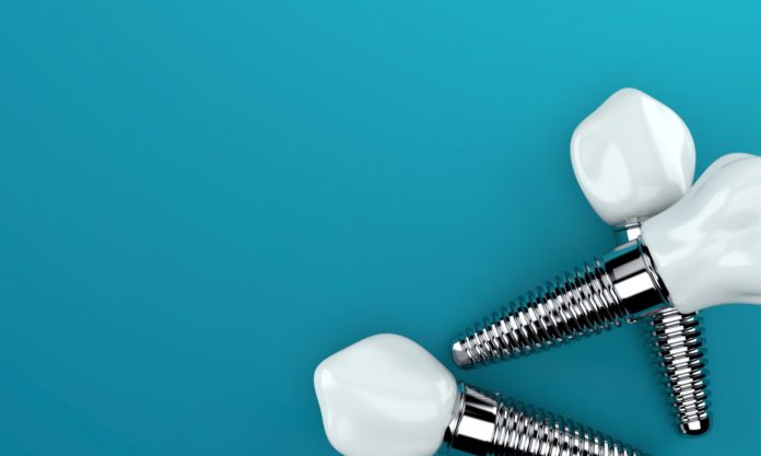 DM_il dentista moderno_Fattori di rischio nel fallimento a breve termine in implantologia