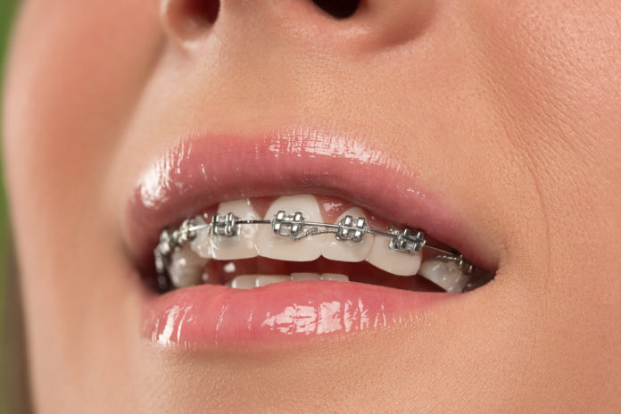 DM_il-dentista-moderno_comunicazione-cellulare-nella-terapia-ortodontica.jpg