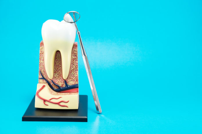 DM_il-dentista-moderno_La-rimozione-dei-perni-endocanalari
