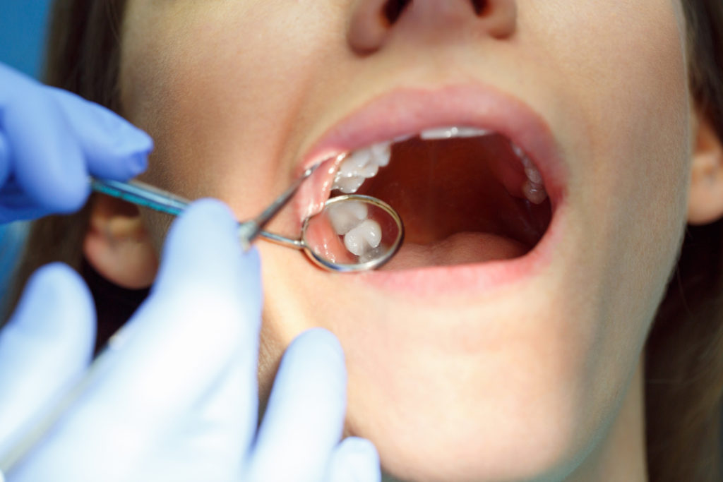 DM_il-dentista-moderno_mini-impianti-ortodonzia_miniviti ortodontiche.jpg
