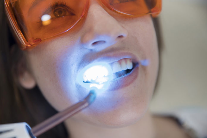DM_il dentista moderno_adesivi_materiali dentari
