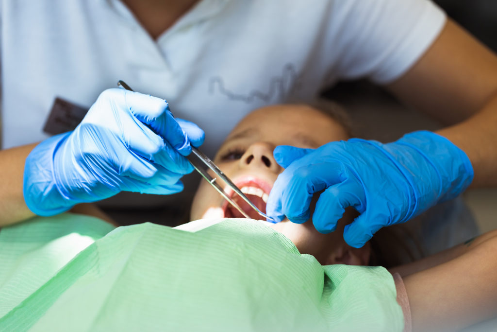 DM_il-dentista-moderno_incappucciamento-pulpare-dente vitale