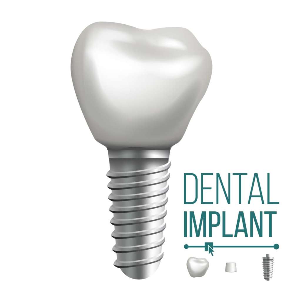 DM_il-dentista-moderno_Impianti-dentali_superficie-implantare.jpg