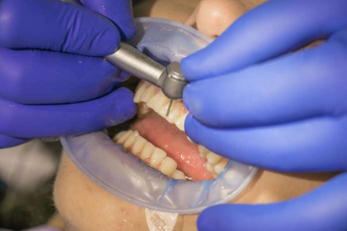 DM_il-dentista-moderno_di-silicato-zirconia.jpg