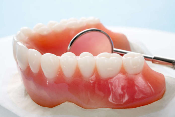 DM_il-dentista-moderno_overdenture_protesi.jpg