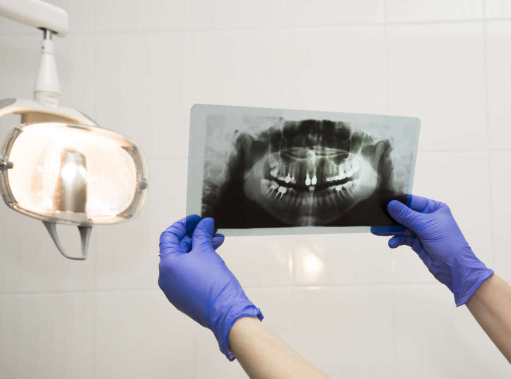 DM_il-dentista-moderno_radiografia_seno-mascellare.jpg