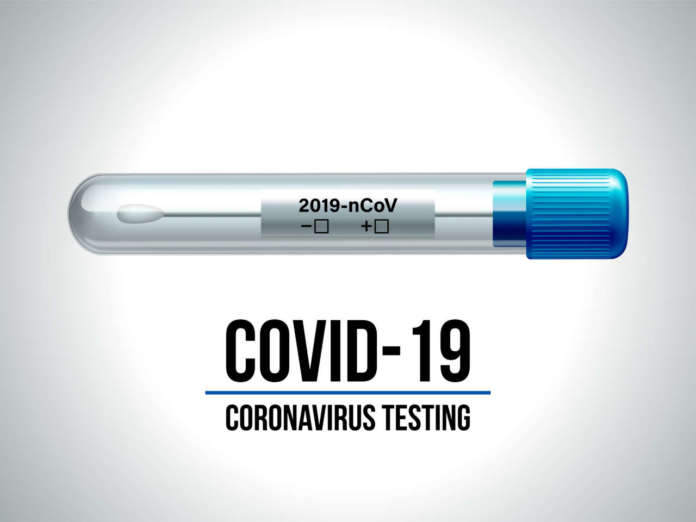Coronavirus_Covid-19_test-ANDI