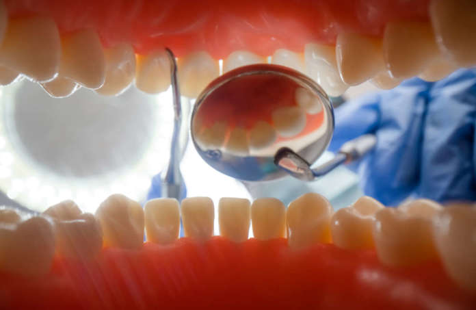 Adesivi dentali